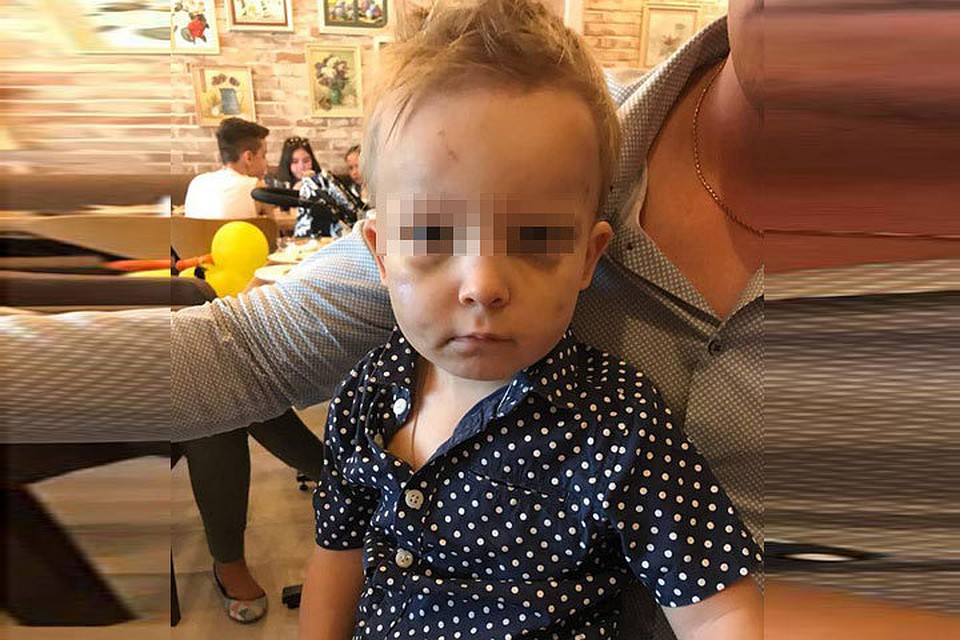 Судмедэкспертиза диагностировала сотрясение мозга, гематомы и ушибы