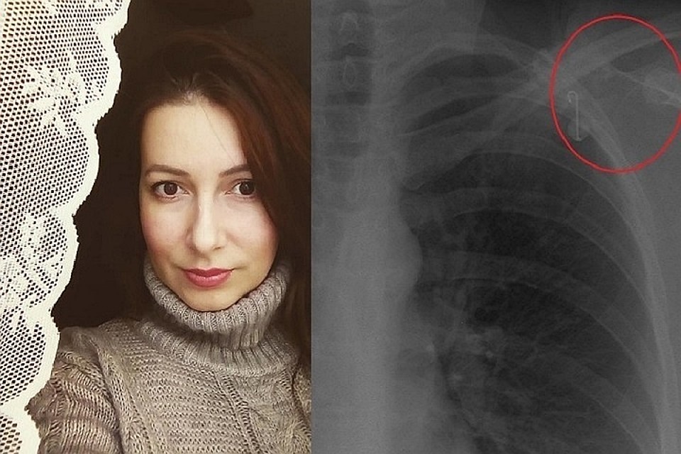 В клинике Мешалкина пригласили женщину на дополнительное обследование. Фото: https://www.instagram.com/khmeleva_photo/