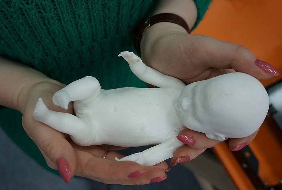 Родители познакомились с будущим сыном заранее. Фото: Уральский центр 3D-технологий
