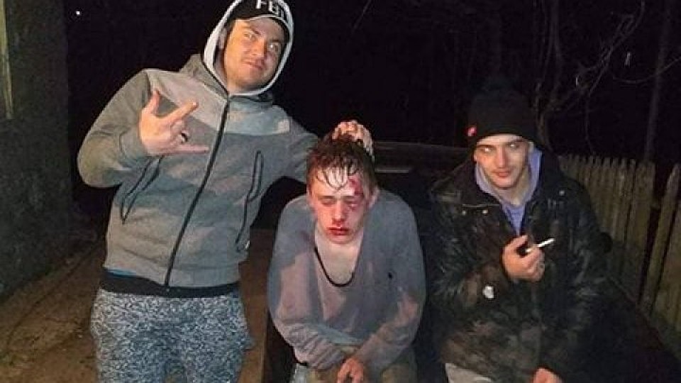 Примерно так выглядят "легкие телесные повреждения"