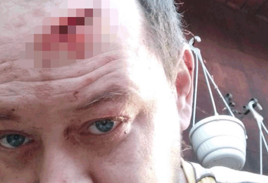 Сосед с вилами напал на дачника Фото: ТВК