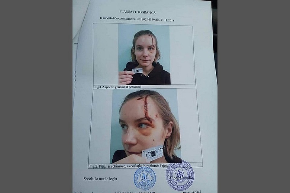 Анастасия после роковой поездки в такси (Фото: соцсети).