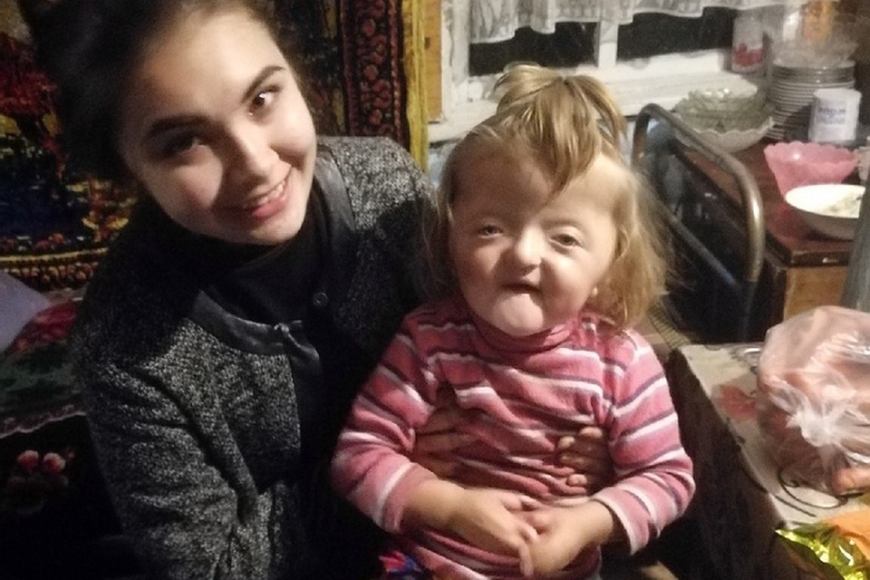 Несмотря на патологии, девочка очень веселая и жизнерадостная