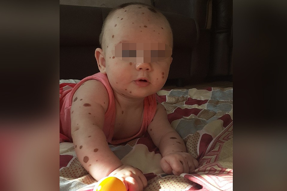 Виктории уже полгодика, она счастливый и активный ребенок. Фото: из архива семьи.