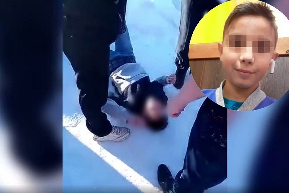 От ударов у Сергея по всему телу синяки и ссадины. Фото: соцсети