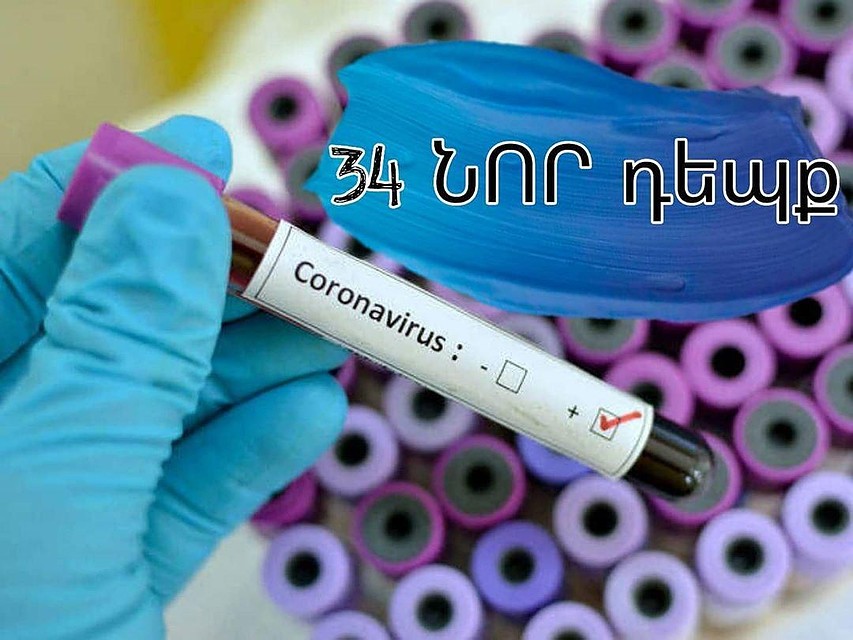 В Армении 34 новых случая коронавируса за сутки