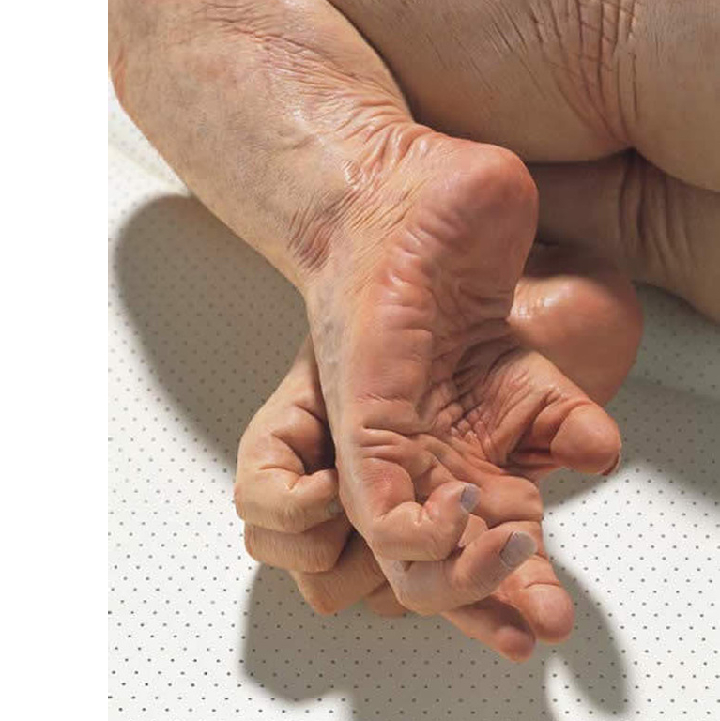 Если бы человек на заре своей эволюции не слез с дерева, то у него вполне моглибы сохраниться хватательные ступни. 