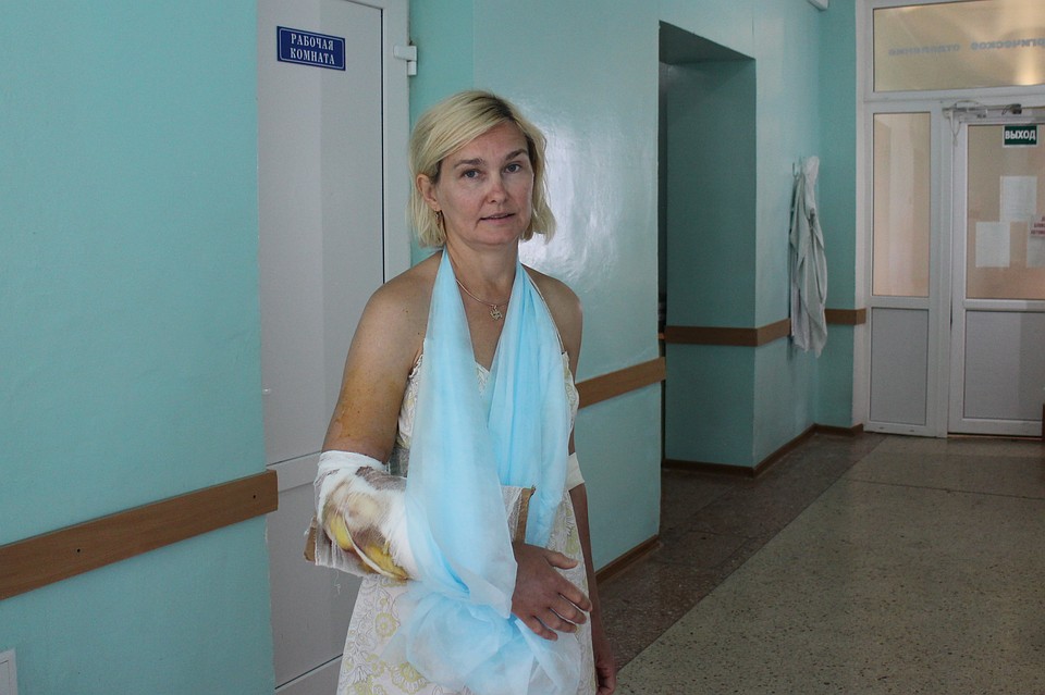 Травмированная рука сильно опухла Фото: Галина КОВАЛЕНКО