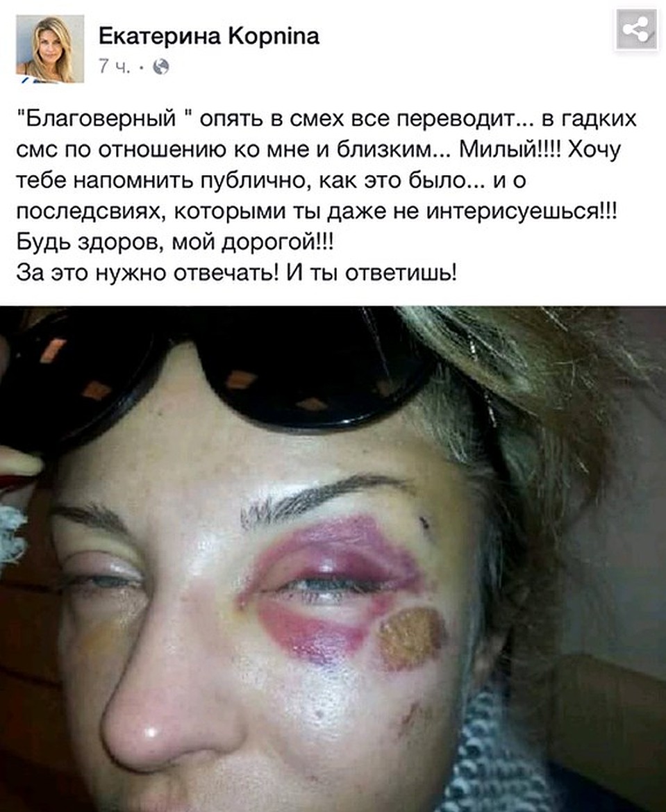 Опубликованные Екатериной Архаровой побои.