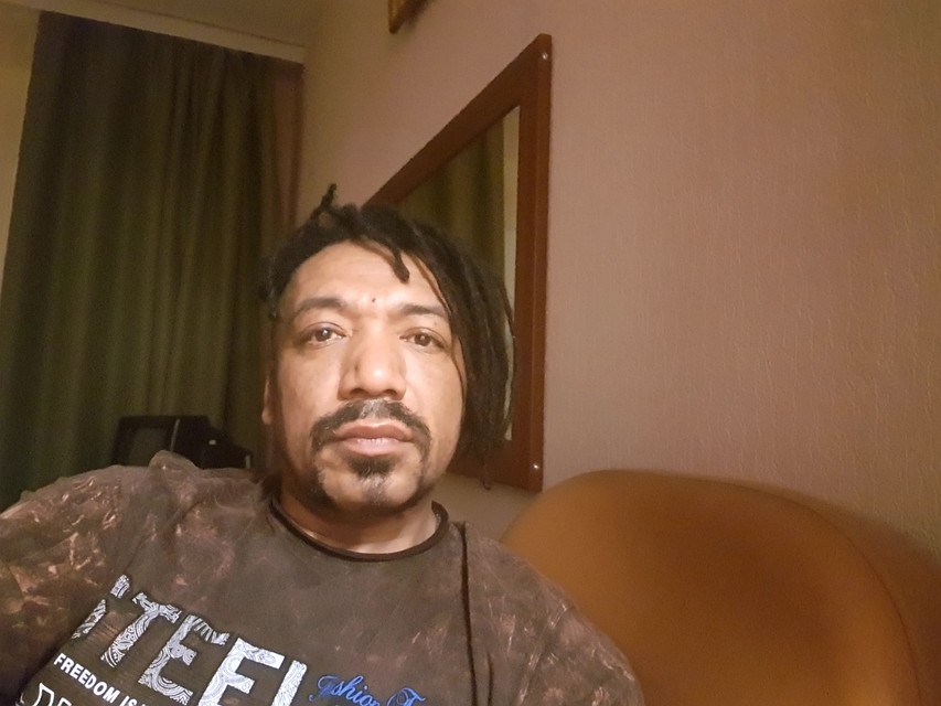 Свой цвет кожи Игорь не может объяснить Фото: Личная страница героя публикации в соцсети