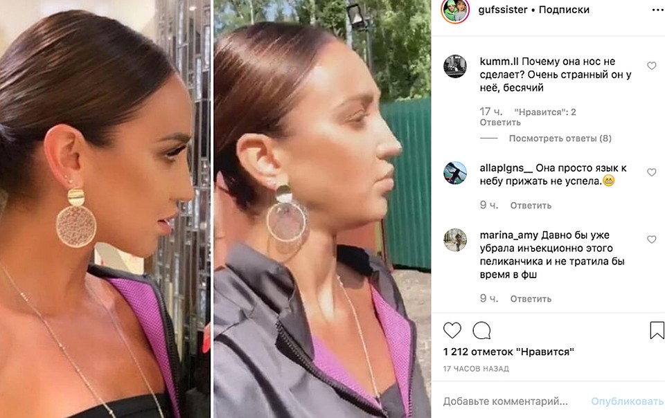 Обсуждение носа Бузовой