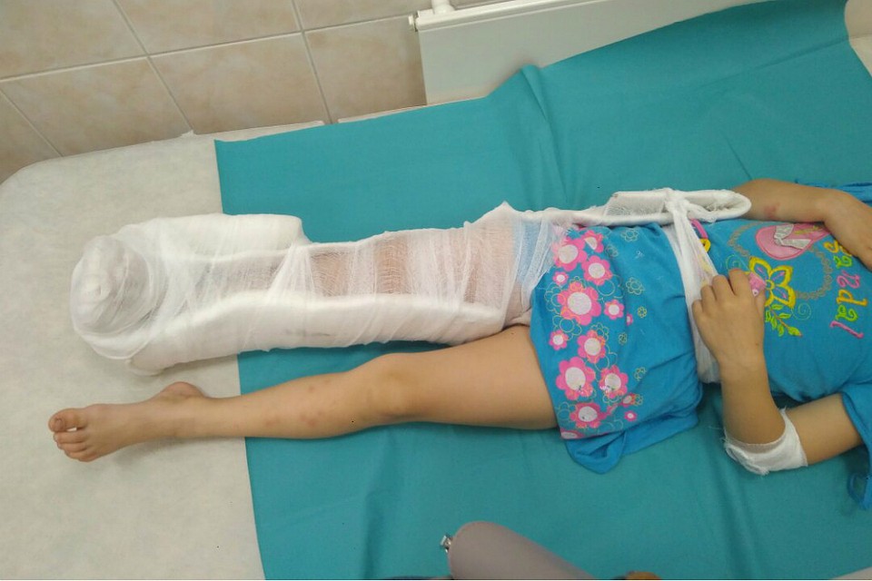 Девочке уже сделали одну операцию, на очереди – вторая. Фото: Из личного архива героя публикации