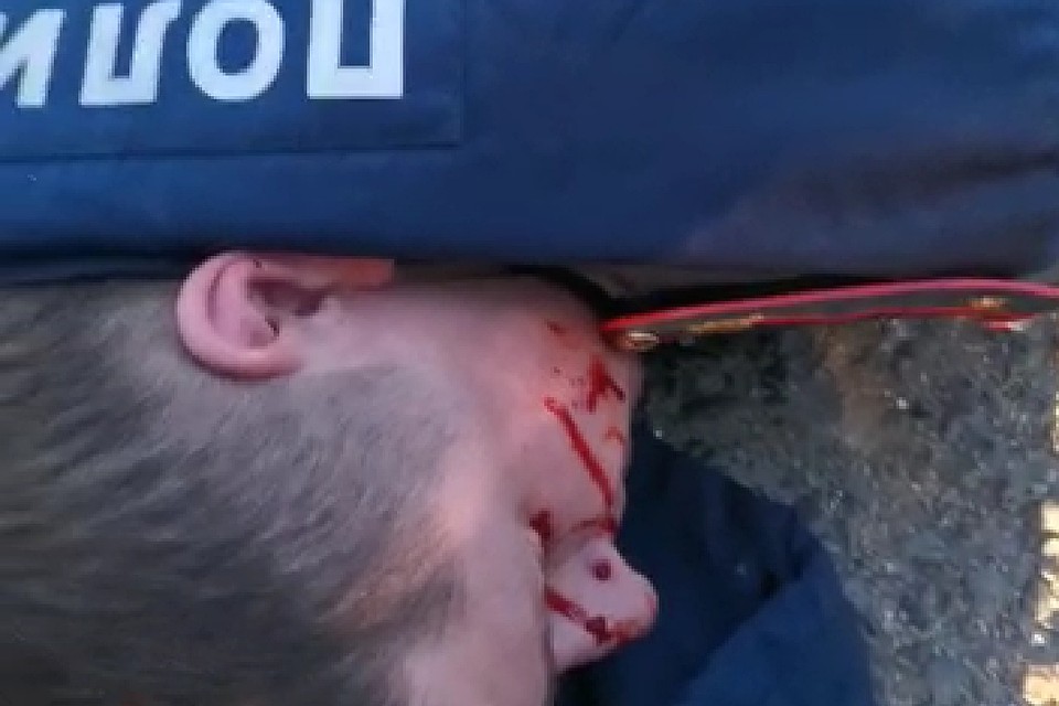 Во время задержания не обошлось без травм. Фото: print screen видео
