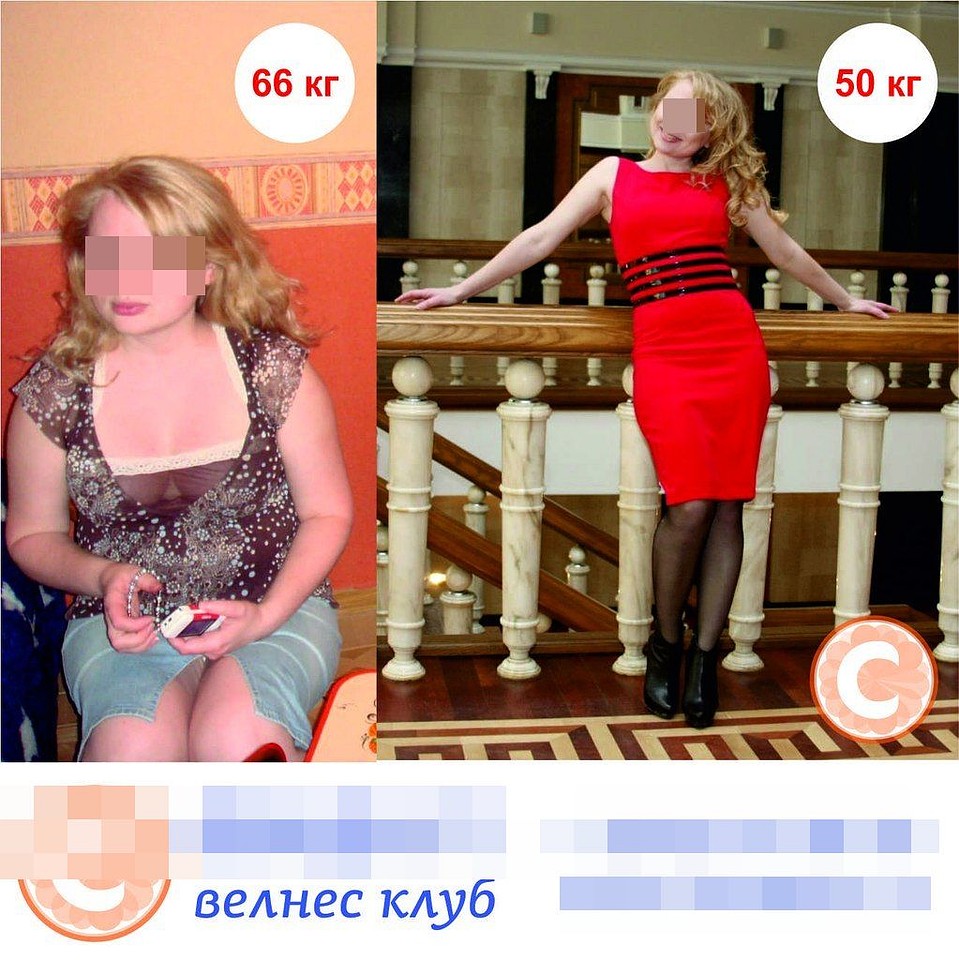 Еще одна похудевшая, которой помогли таблетки. Фото: соцсети.