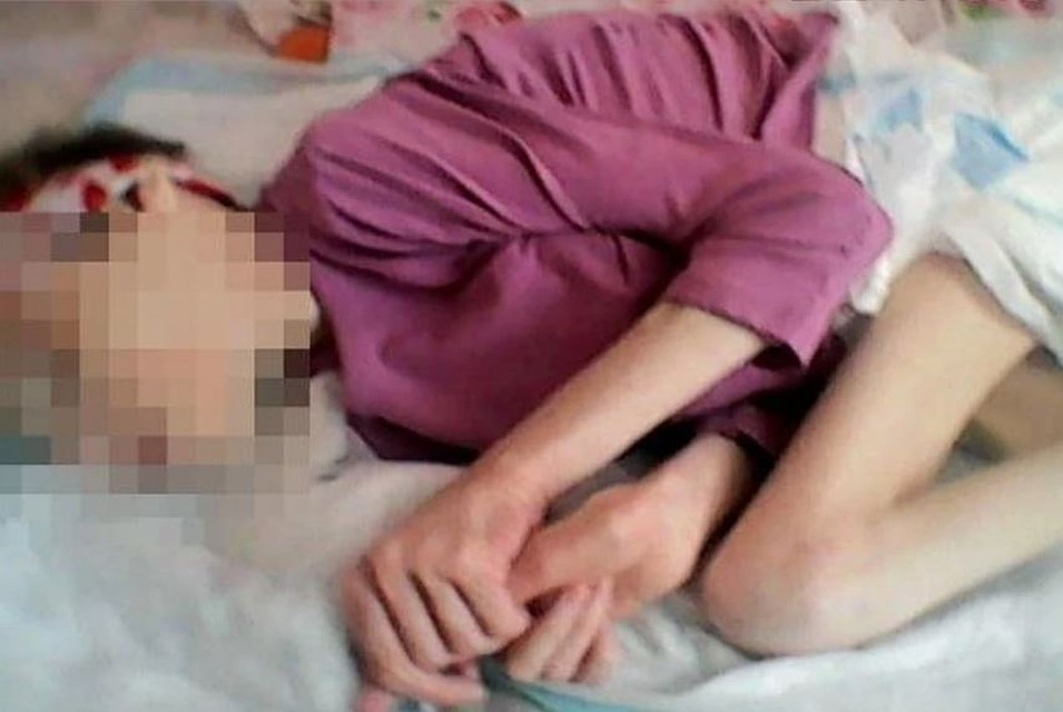 В начале января из-за ненадлежащего ухода девушка страшно исхудала. Фото: Наталья Галеева.
