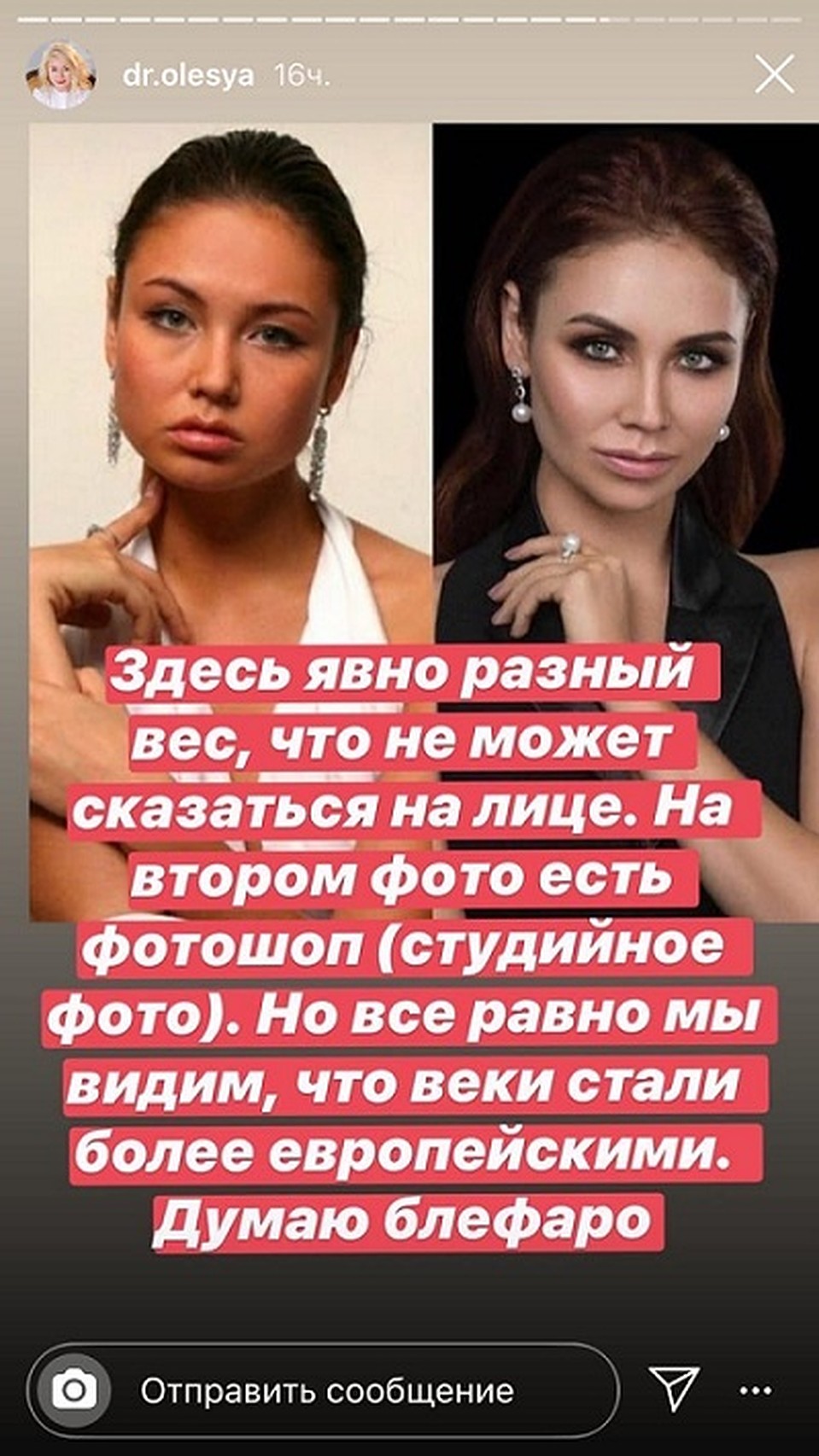 Сториз из Инстаграм