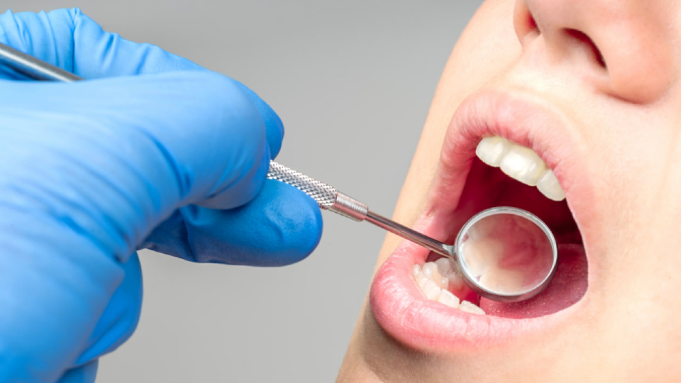 Пародонтит у взрослых