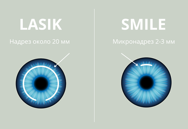 Лентикулярные