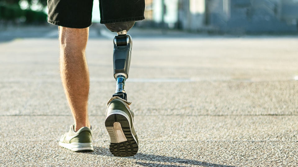 Лучшие центры протезирования конечностей в Москве в 2025 году