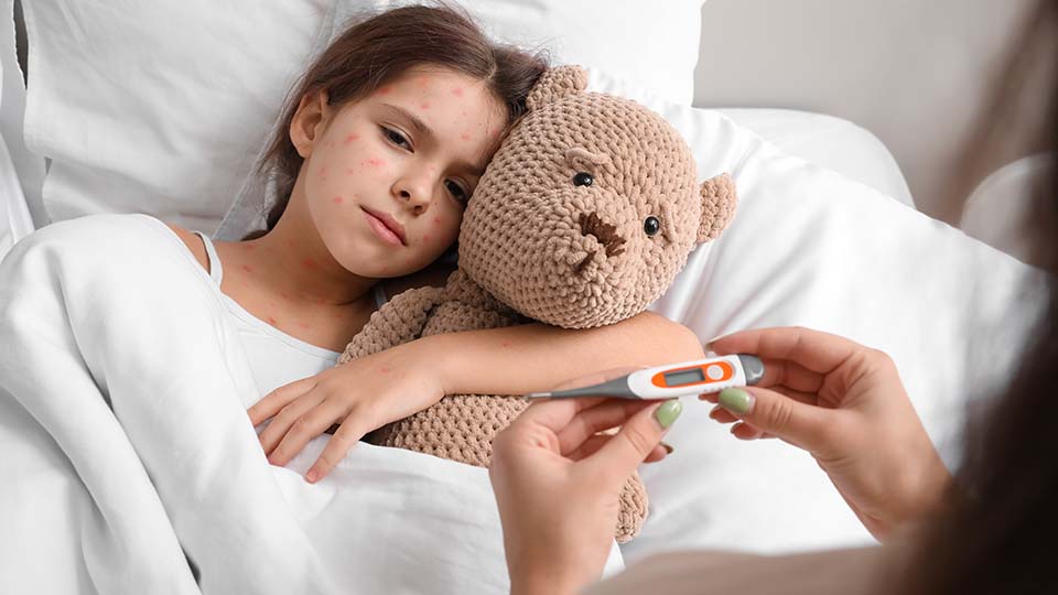 Симптомы и признаки ветрянки у детей