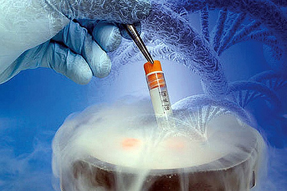 Cryo freezing of sperm, man fingering man