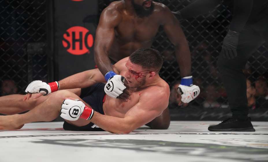 Вадиму Немкову зашили бровь, рассеченную во время боя. Фото: Global Look Press