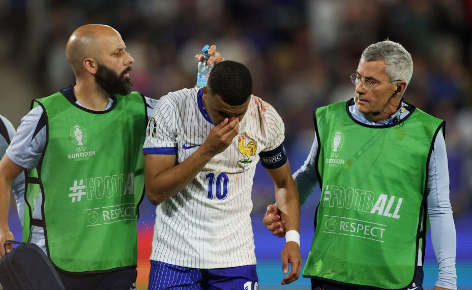 Килиан Мбаппе покинул поле весь в крови. Фото: Reuters